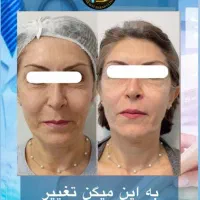 هایفو۷و۱۲بعد/حجم‌سینه‌باسن/پی‌آر‌پی/لیزرموهای زائد