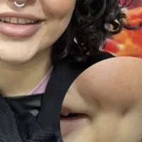 تخفیف محدود چال‌گونه دائم با بخیه و انواع پیرسینگ