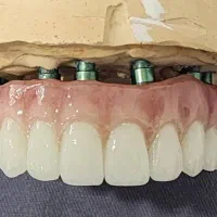 لابراتوار دندانسازی نیکامهر