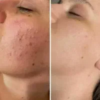 پک های حرفه ای بیوممتیک مناسب پوست شما