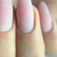 هیشکی نمیدونه آفتاب یک کاشت و ترمیم فقط ۴۰۰ تومنه