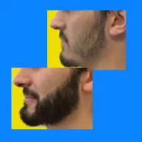 جاهای خالیتو. پوشش بده