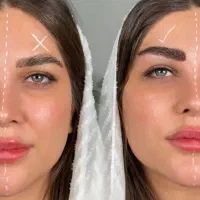 کاشت ابرو جشنواره تخفیفی میکروکاشت