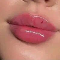 بوتاکس، فیلر، مزو