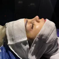 آف جراحی بینی ۲۹ت دراهوازولیپوابدوولیفت صورت
