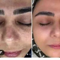 پماد بیومتیک اصل
