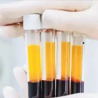 جشنواره تخفیف مزوتراپی و prpمو