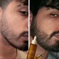 باریش وسبیل پر پشت خاص باش