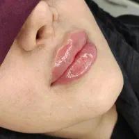 استخدام منشی و دستیار پزشک مطب زیبایی در یاسوج