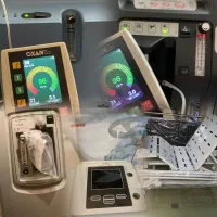 دستگاه اکسیژنساز ویژن ایر بای پپ استلار150وپس