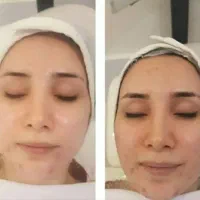 پوستتو ناز کن