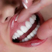 دندانپزشکی .کامپوزیت .روکش . دندان متحرک