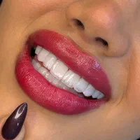 کامپوزیت دندان واحدی ۱/۵۰۰ بدون پیش پرداخت