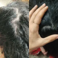 اکسیر ریزش مژه و ابرو
