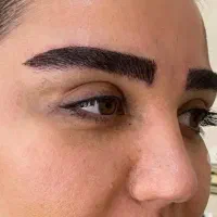 کاشت مو وابرو با تراکم بالا  شرایط اقساطی