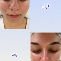 پاکسازی پوست