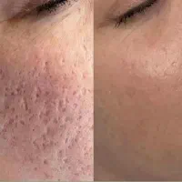 وایتکس پوست