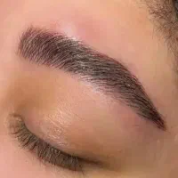 اپیلاسیون بانوان