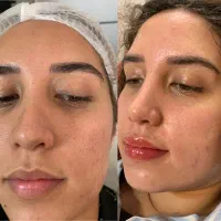 پاکسازی و درمان پوستی جذب هنرجو خانم و آقا