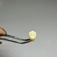استخدام دندانساز، پرسلن گزار، لابراتوار دندانسازی