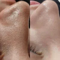فشیال وجوانسازی تخصصی پوست