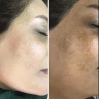 کرم بیوممتیک با ضمانت نامه ضد لک و ضد چروک