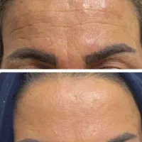 تخفیفی بیوممتیک جهانی ...موجودی محدود