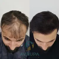 شانس در خونت زده