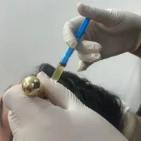 همکار مسلط به فیلر و‌ بوتاکس