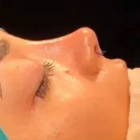 عمل جراحی زیبایی بینی ،گوش،لیفت،اندام