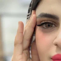 کاشت مژه پیامبر اعظم فقط ۳۵۰