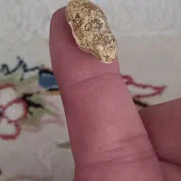 مهره