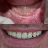 دندان مصنوعی / لابراتوار دندانسازی / پروتز متحرک|خدمات آرایشگری و زیبایی|تهران, افسریه|دیوار