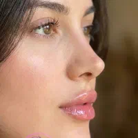 جشنواره تزریق ژل و بوتاکس و فیلر