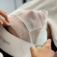 انواع خال وفیشال وپی ارپی ومزو وهایفو در مطب پزشک
