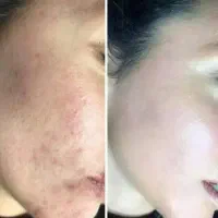 توی یکماه سفید برفی شو