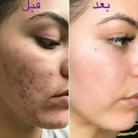 کرم های جوانسازی