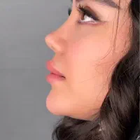 عمل بینی،رفع غبغب،دایرکت ابرو لیپو،ابدو لیفت،کاشت
