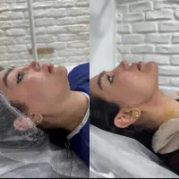 شگفتانه تابستانه سوپرکانتور غبغب