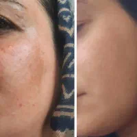نماینده رسمی کرم تیرگی گاتیو