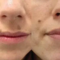 خالبرداری ویژه بانوان با قیمت باورنکردنی