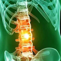 افزایش قد تضمینی و زخیم سازی غضروف ها