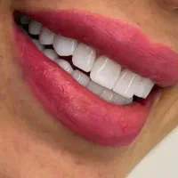 خدمات دندانپزشکی کامپوزیت فکی فقط 8 میلیون
