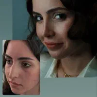 تخفیف ویژه عید برای عمل بینی+مشاوره تخصصی رایگان