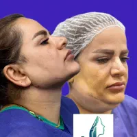 زاویه سازی صورت و فک + آر اف رایگان + بوکال