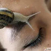 حلزون مخصوص حلزون تراپی کلاژن ساز
