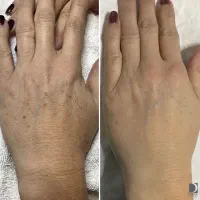 ژیلت روبنداز دور اینجاپوست مخملی،رویانیست،حقیقته