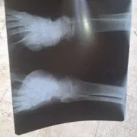 فروش و خریدار عکس رادیولوژی دراستان تهران درمحل
