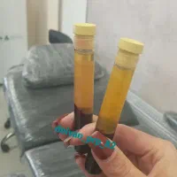 جوانسازی ، تقویت مو ، پی ار پی ، کاشت