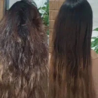 مشاوره و مراقبت از مو/ ریزش و کم پشتی